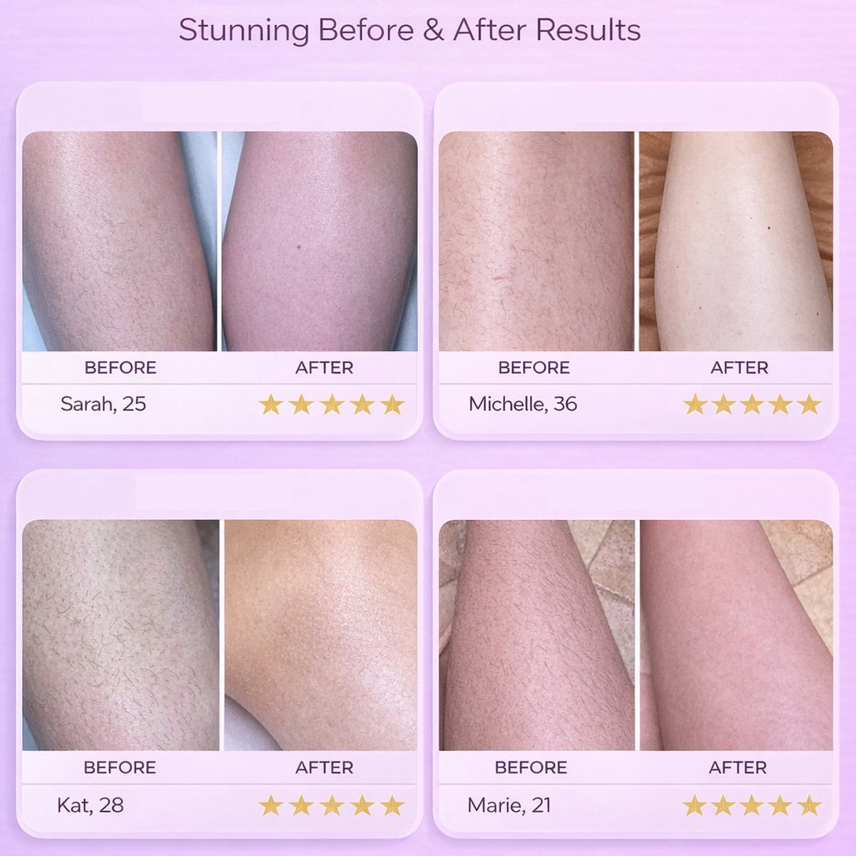 Nounna™ SoftTouch Hair Remover