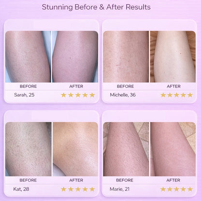 Nounna™ SoftTouch Hair Remover